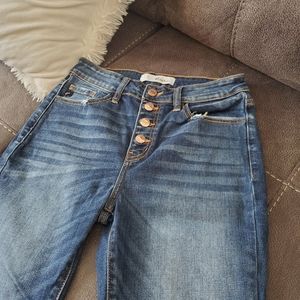 Kancan rosegold 4 button